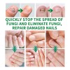 M Jaysuing Tratamiento Hongos De Uñas Herbal 30ml Neutra