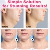 Faja Facial Mentonera Reafirmante Para Bichectomía Grande