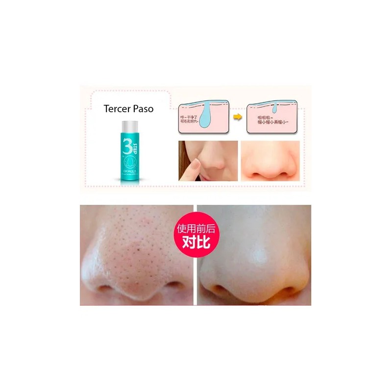 Holika Pig Nose Puntos Negros 3 Pasos Anti Acne Aclarante
