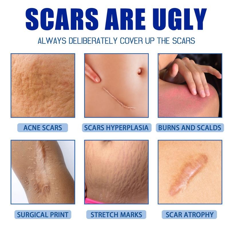 Professional Scar Removal Gel- Scarremoval treatment for keloids, C-sectionS, surgeries,