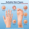 BPLXKUR Wart Remover – Gentle OTC with Natural Plant Extracts,