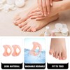 Kecartu 12 PCS Pinky Toe Spacers, Light Pink