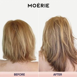 Champú Para El Crecimiento Del Cabello Moerie Ultimate Para