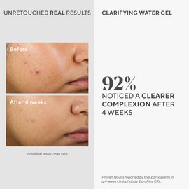 Murad Clarifying Water Gel - Non-Comedogenic Light Gel Moisturizer for Face, Neck & Chest - Facial Skin Care Product Hydrates with Non-Greasy Finish, 2 Fl Oz