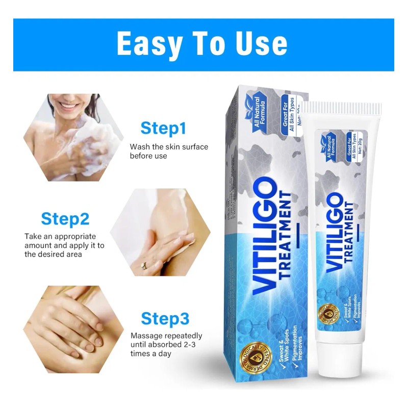 Tratamiento De Vitíligo, Tratamiento Natural De Crema De Vit