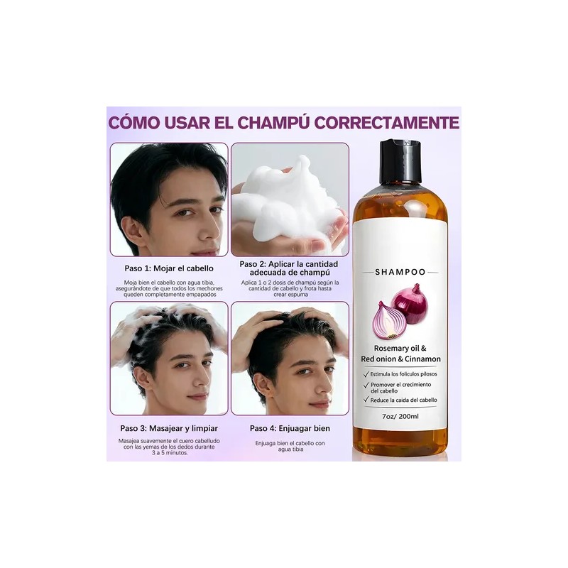 2pzs Shampoo Lexenic Excalvo Con Cebolla Y Aceite De Romer