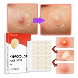 Set De 144 Parches Faciales Hidrocoloides Espinillas Antiacn Todo Tipo De Piel Día/noche