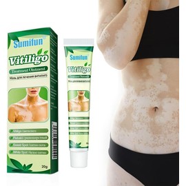 Crema para el vitíligo, crema para el tratamiento del vitíligo, crema para el cuidado del vitíligo corporal para reducir las manchas blancas y la psoriasis (Paquete de 1)
