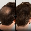 SHAKE OVER Applicator for scattered hair for thickening hair -