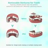 Custom Partial Dentures for Missing Teeth, Removable Dentures for Teeth,