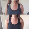 Tomsey Bra Clips, Racer Back Strap Concealer, Cleavage Enhancer and
