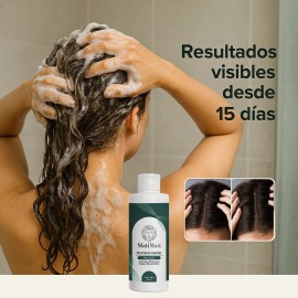 Shampoo Anticaspa Con Alquitrán 425ml Psoriasis Matimati