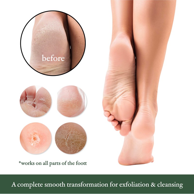 TADA Natural Beauty ADA Natural Beauty Pumice Stone for Feet