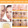 Ácido Glicólico 7% Solución, Exfolia, 240 ml (A)
