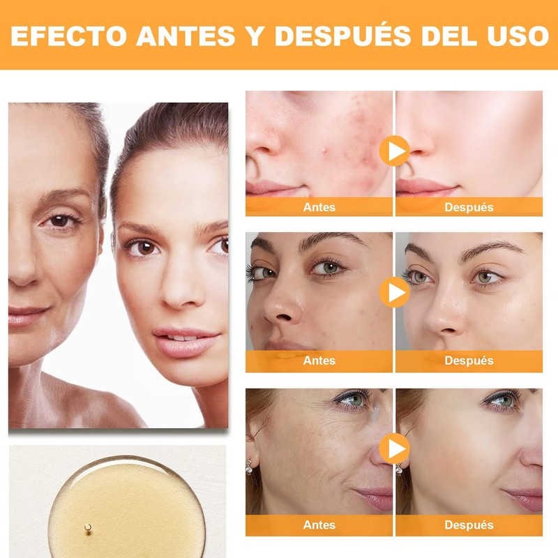 Ácido Glicólico 7% Solución, Exfolia, 240 ml (A)