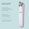 Howlite Vacuum, Limpiador facial contra puntos negros e imperfecciones