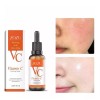 Zozu Serum Vitamina C Original Elimina Manchas Paño Pecas Hidrata