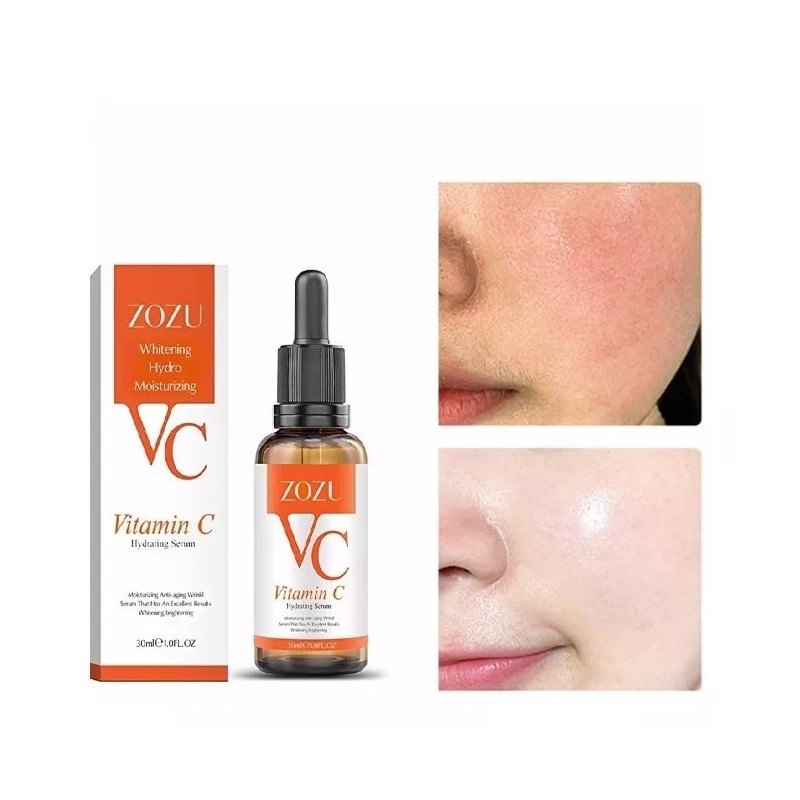Zozu Serum Vitamina C Original Elimina Manchas Paño Pecas Hidrata