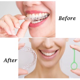 NITAIUN 2 x Braces Box and 6 x Aligner Removal Tool, Invisible Tooth Removal Extractor Oral Corrector Retainer Extractors Storage Case of Dentures (8 Pieces)