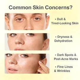 Sérum Facial de Vitamina C con Niacinamida y Ácido Arbutín – Ilumina la piel visiblemente, ayuda a reducir las manchas oscuras y los signos de la edad para un brillo radiante – 30ml / 1.01 fl. oz.