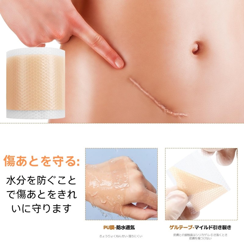 TiaysTiays 傷跡ケアテープ ケロイド テープ 4cm×300cm 肌色 傷あとケア用シリコンジェルシート 傷隠しテープ