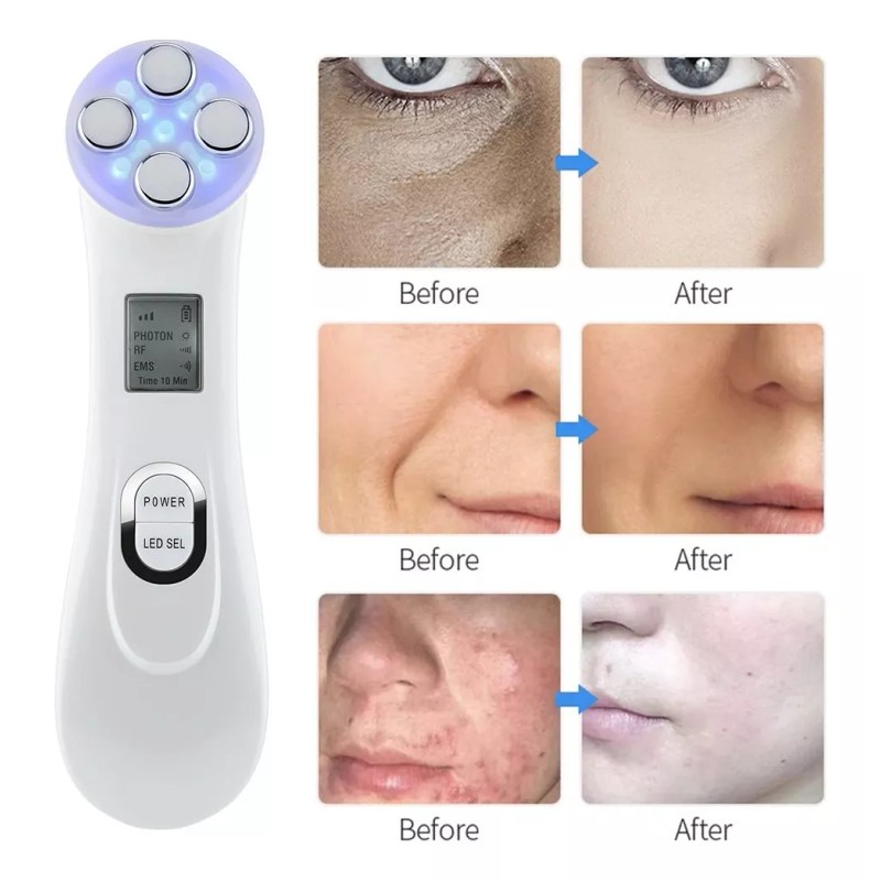Dearbeauty Máquina Facial Ems+ Reafirmante+led +electroporador Arrugas