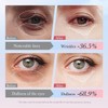 KPJFZFEY Eye Cream with 10% Hyaluronic Acid, 5% Nicotinamide, 30%