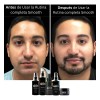 Kit Facial Smooth Skin Care Para Hombre Piel Mixta A