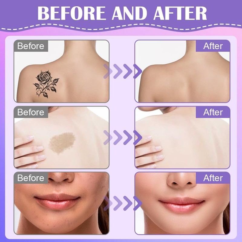 AOOWU Leg Makeup, 2 Pack Body Coverage Perfector, All Over