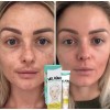 Crema Despigmentante Para Manchas,melasma, Acné Y Paño 2pzs