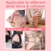 HayZBao High Torque Electric Foot File - Callus Remover for