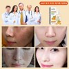 Brightening/Essence/30mL/Whitening/Vita/Serum/Melasma/Whitening/Essence/Ampoule/Spots/Removal/Whiten