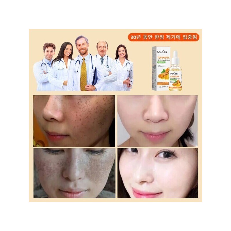 Brightening/Essence/30mL/Whitening/Vita/Serum/Melasma/Whitening/Essence/Ampoule/Spots/Removal/Whiten