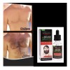 Tratamiento Para Crecimiento De Barba Y Bigote