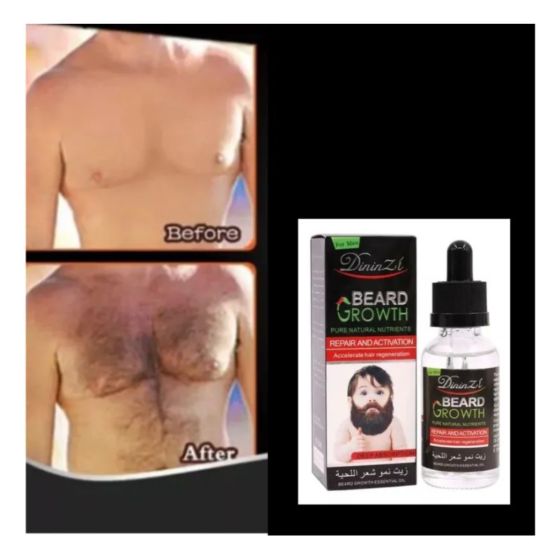 Tratamiento Para Crecimiento De Barba Y Bigote