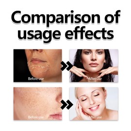 Hyaluronic Acid Powder,Natural Hyaluronic Acid Powder for Face and Skin Care,Water Soluble Hydrating Ingredient for Skin Moisture,Water-Soluble Firming Facial Serums Cosmetics,DIY Facial Serum