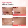 Dr.Different Vitalift-A Fortessimo Retinal 0.15 - Crema Antiarrugas De Grado