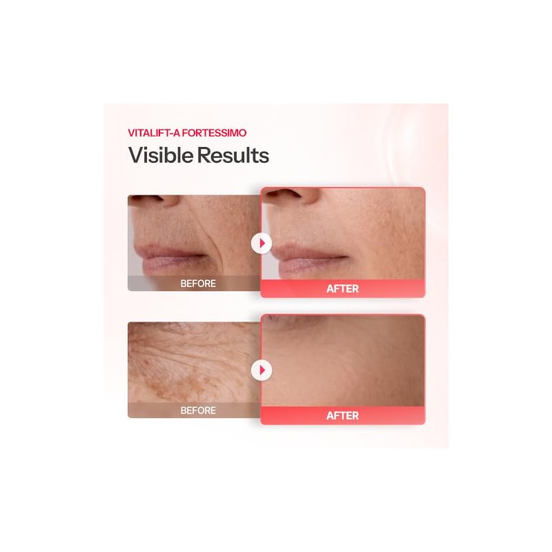 Dr.Different Vitalift-A Fortessimo Retinal 0.15 - Crema Antiarrugas De Grado