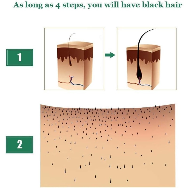 Tratamiento de pérdida de cabello Esencia de crecimiento del cabello