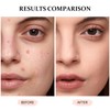 Concealer Full Coverage for Mature Skin - Eye Concealer Concealer