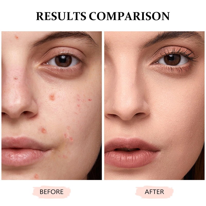 Concealer Full Coverage for Mature Skin - Eye Concealer Concealer