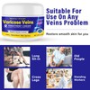 Varicose Veins Treatment for Legs, Varicose Veins Cream Improve Blood