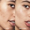 E.l.f. Skin Blemish Breakthrough - Gel Para Combatir El Acné