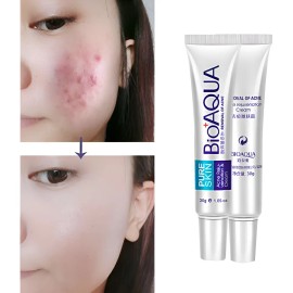 Crema Anti Acné Barros Granos Hidrata Puntos Negros Aclara Indistinto