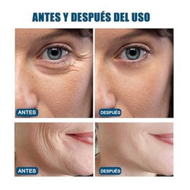2PCS Mineral 89 Probiotic, Mineral 89 Serum, Esencia Facial, Hidratación Intensa, Reduce la Aparición de Líneas Finas.