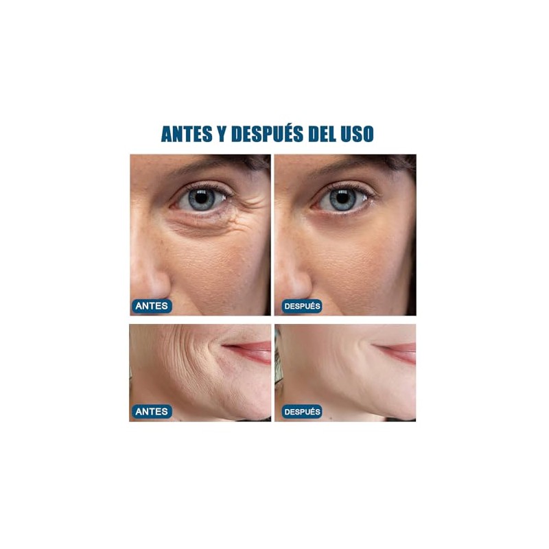 2PCS Mineral 89 Probiotic, Mineral 89 Serum, Esencia Facial, Hidratación