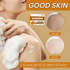 Turmeric Soap Bar, Natural Kojic Acid Soap, Turmeric and Kojic Acid Soaps, Brightens Skin, Fades Dark Spots & Acne. Enriched with Collagen & Vitamin C for Even Tone & Smooth Glow, Gentle (100g)