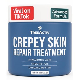 TreeActiv Tratamiento reparador de piel Crepey, fórmula original, 8 fl oz, crema reafirmante para rostro y cuello, loción reafirmante para la piel con ácido hialurónico, tratamiento para piel Crepe