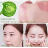 Eko bella Aloe Vera Sabila Bioaqua Acido Hialuronico Vitamina C
