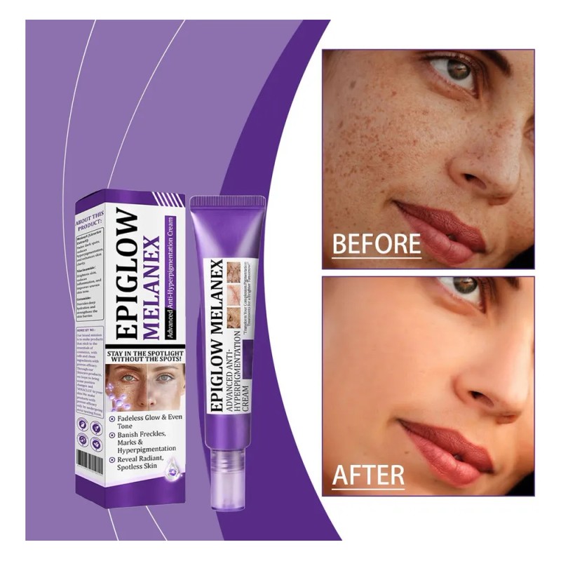 Crema Facial Antimanchas Resist 30g Hidratante